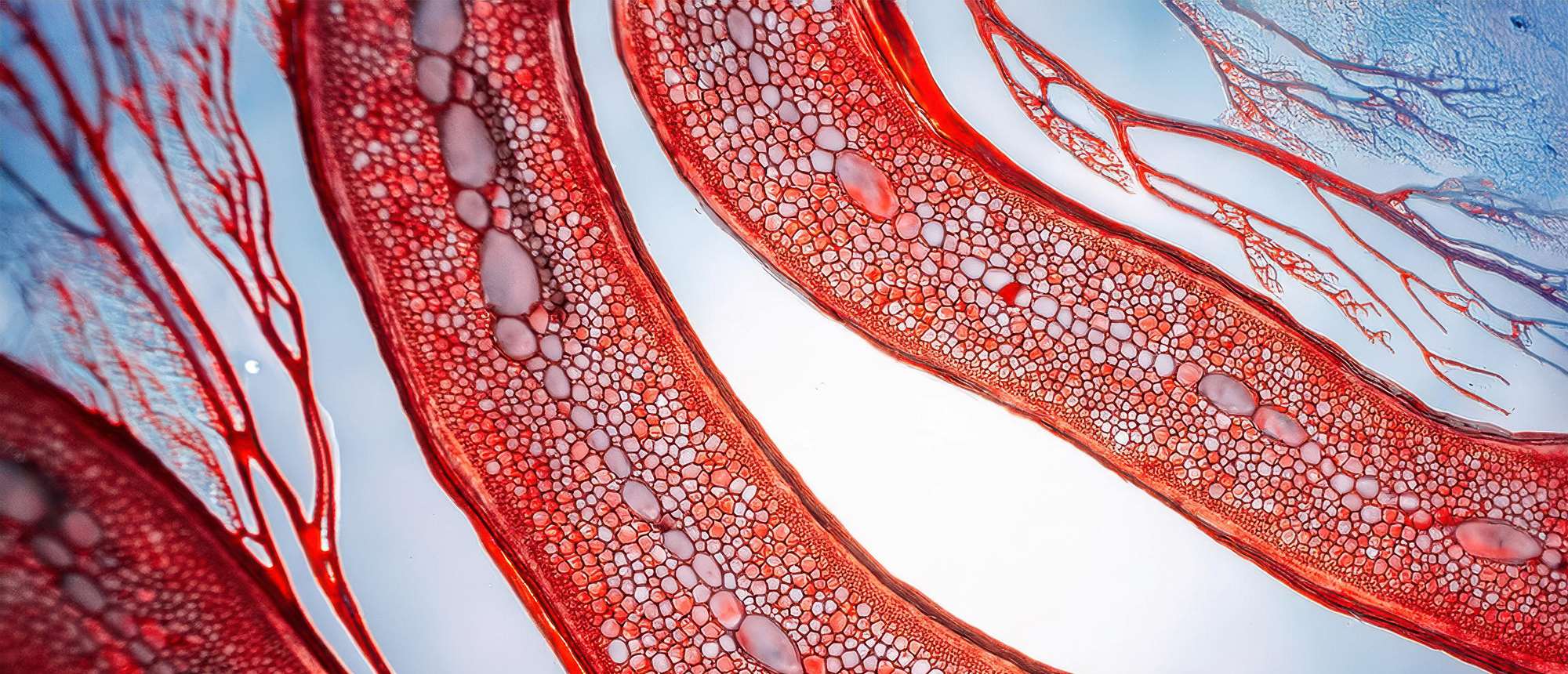 Arterial blood cells