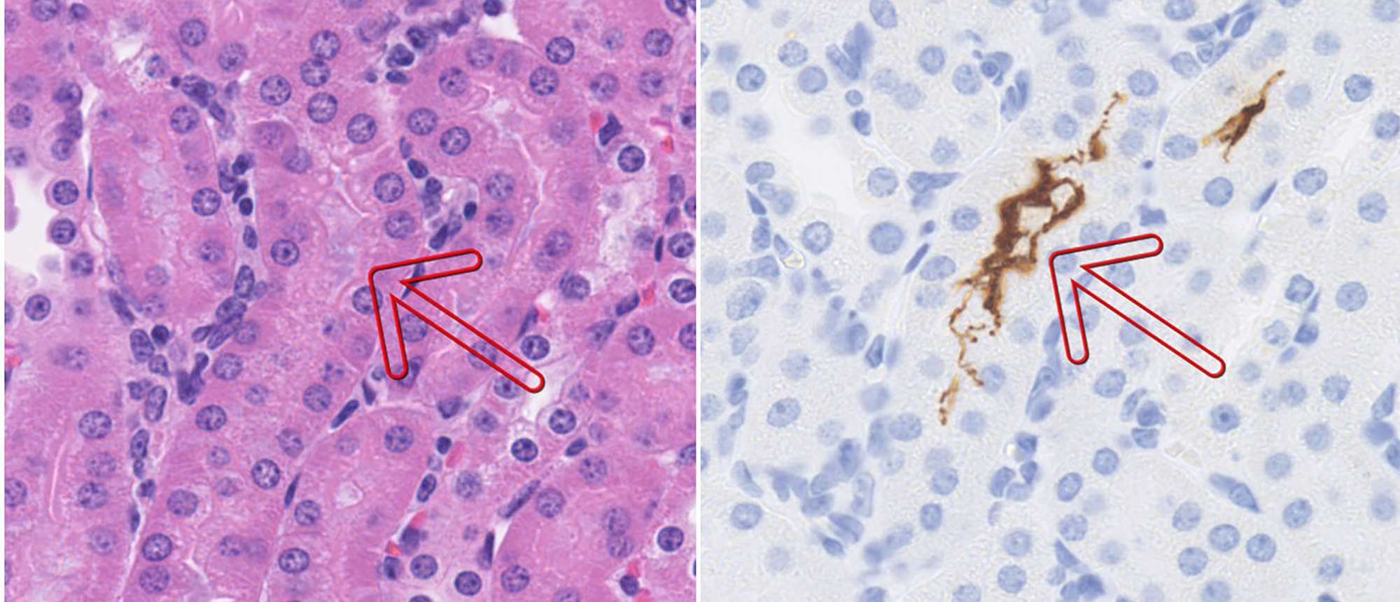 Leptospira cells