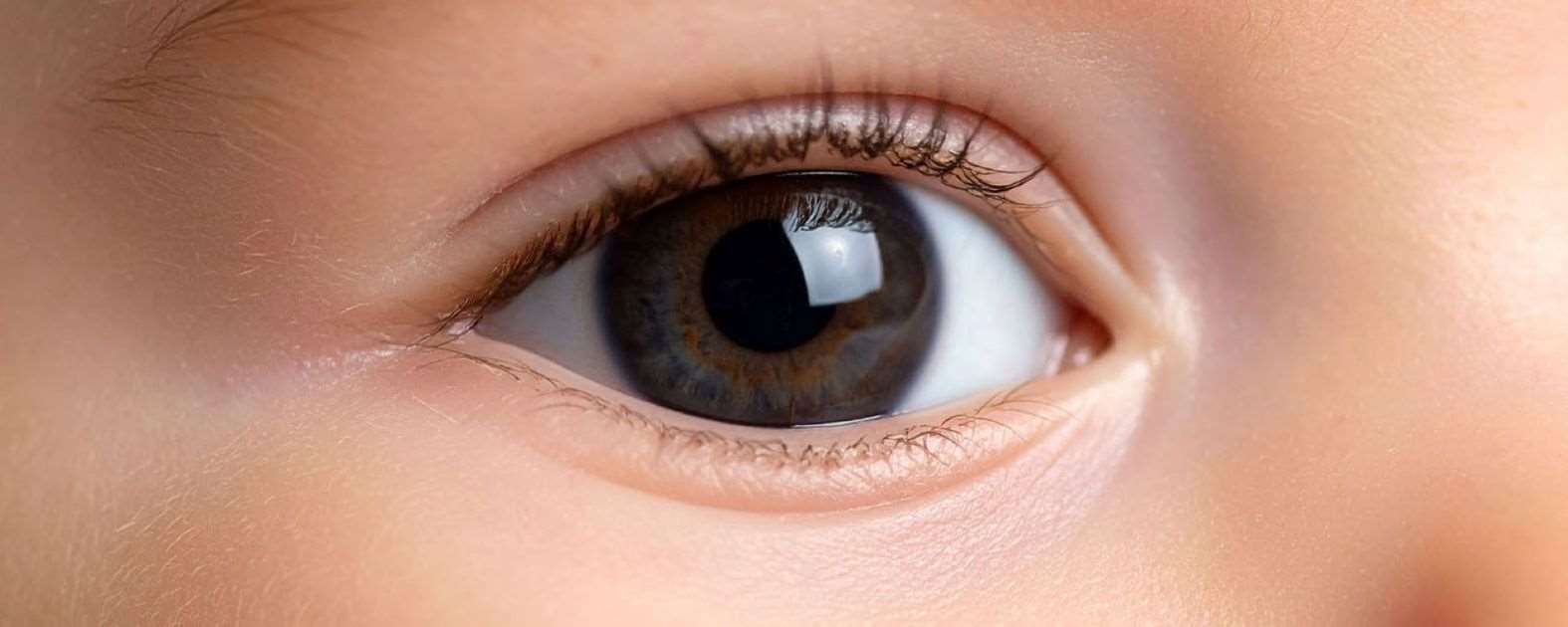 Using Artificial Intelligence to Identify High-Risk Cases of Rare ...
