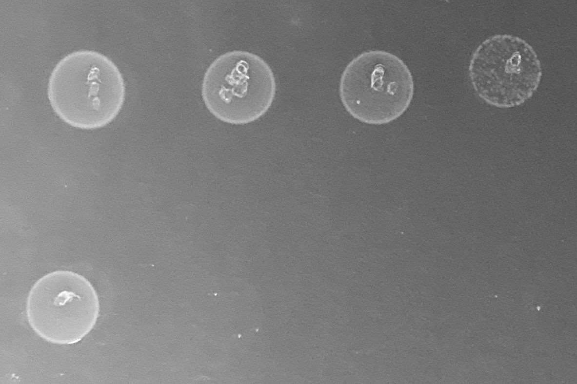 E faecalis colonies under microscope