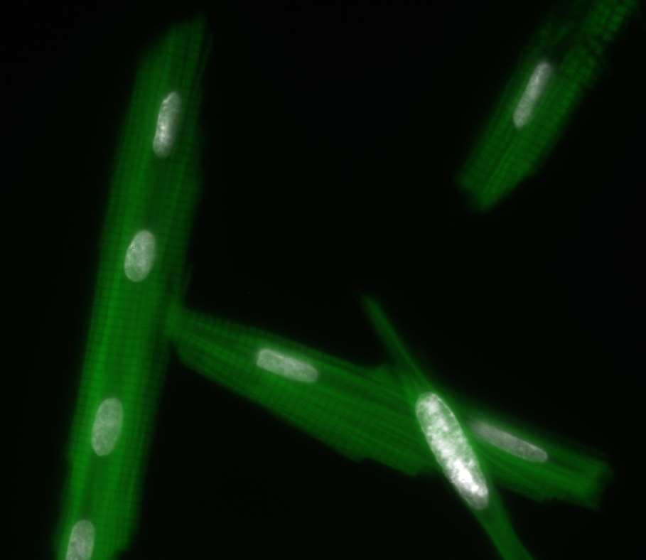 Polyploidy cells
