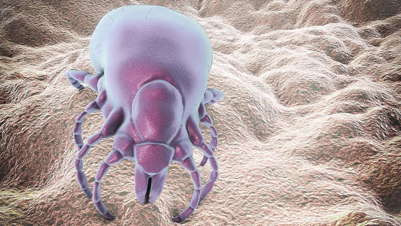 Image of a tick