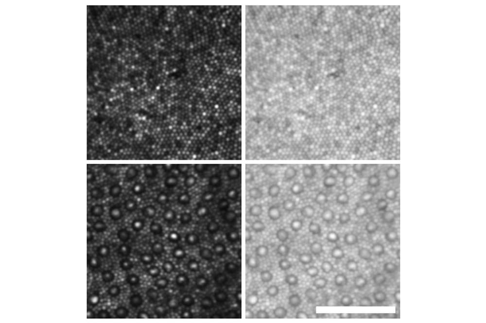 AOSLO_fovea_periphery