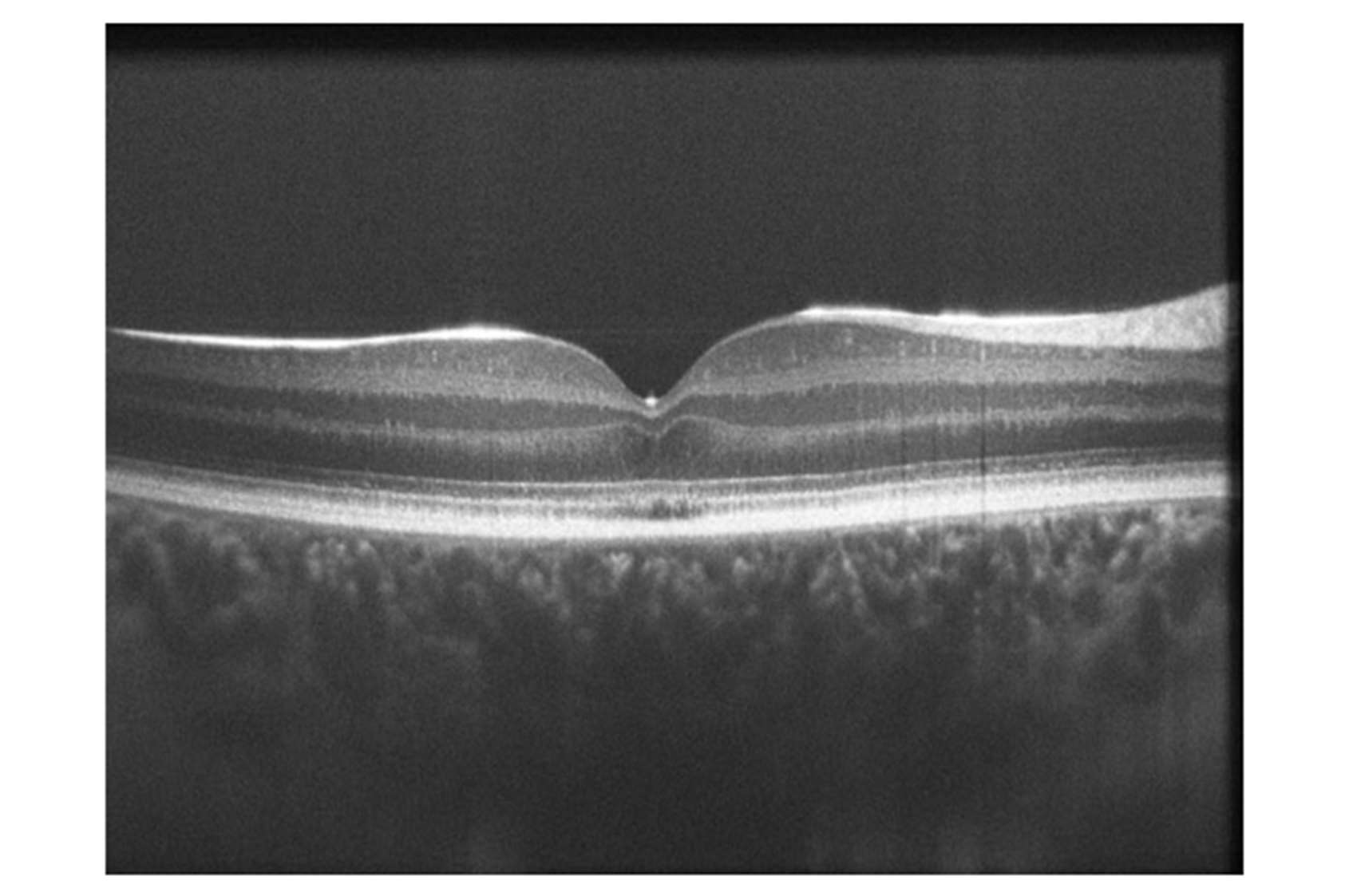 Retinal Image Galleries | Advanced Ocular Imaging Program | Medical ...