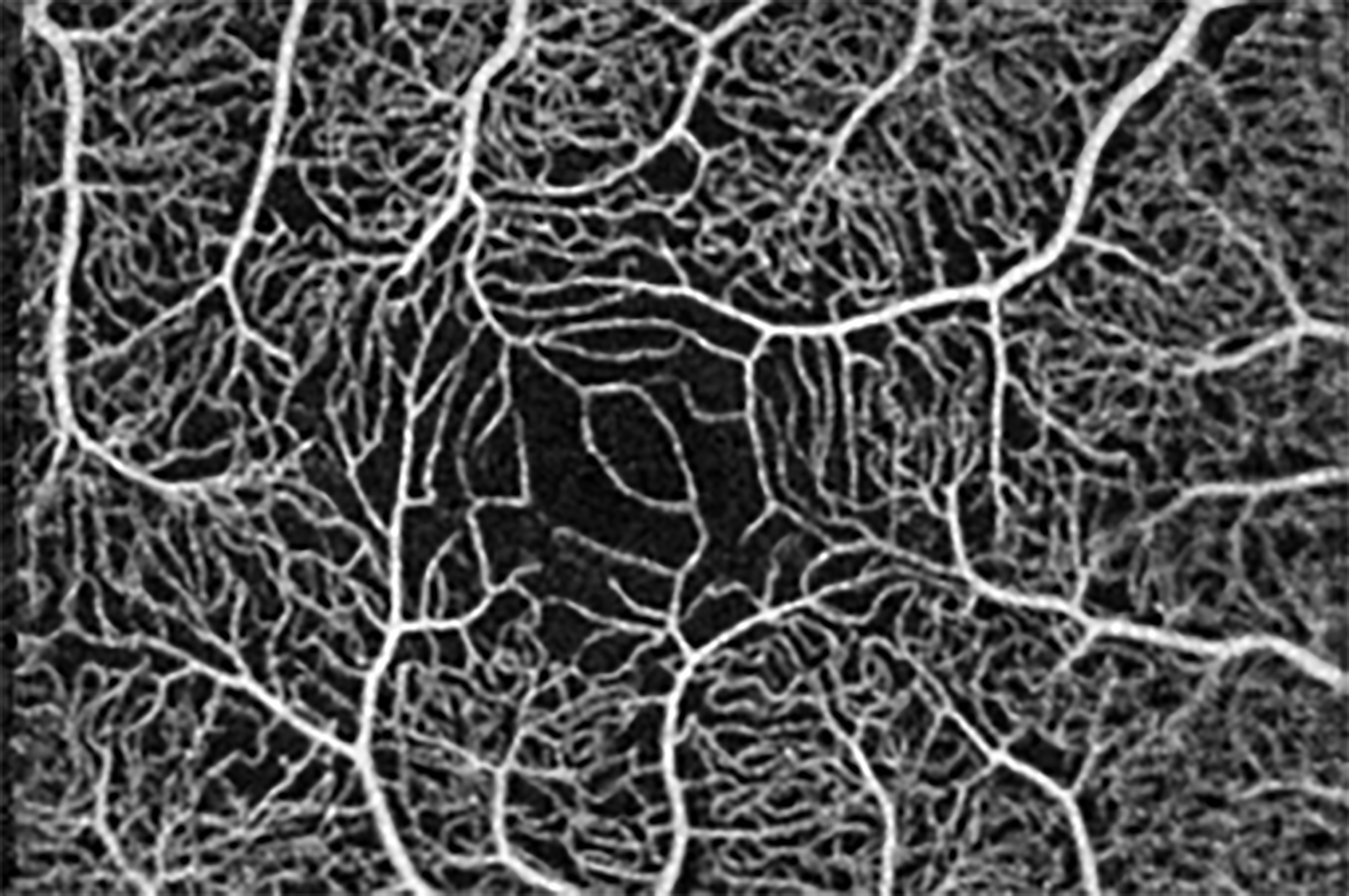 JC_11068_OD_avg_v3_Image Gallery