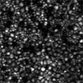 Hansen_2013_Retina