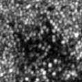 Hansen_2015_RetinaCasesBriefRep