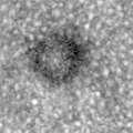 Land_2014_OptomVisSci