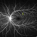 Pinhas_2015_Retina
