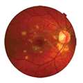 Stepien_2011_JOphthalmol