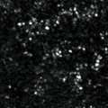 Sun_2017_AmJOphthalmolCaseRep