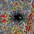 Zhou_2020_PLOS
