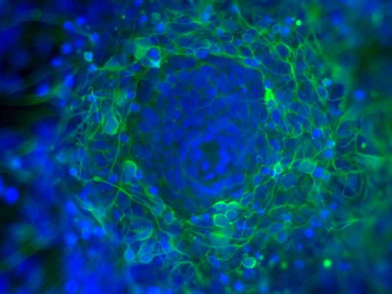 neurons differentiated from human embryonic stem cells