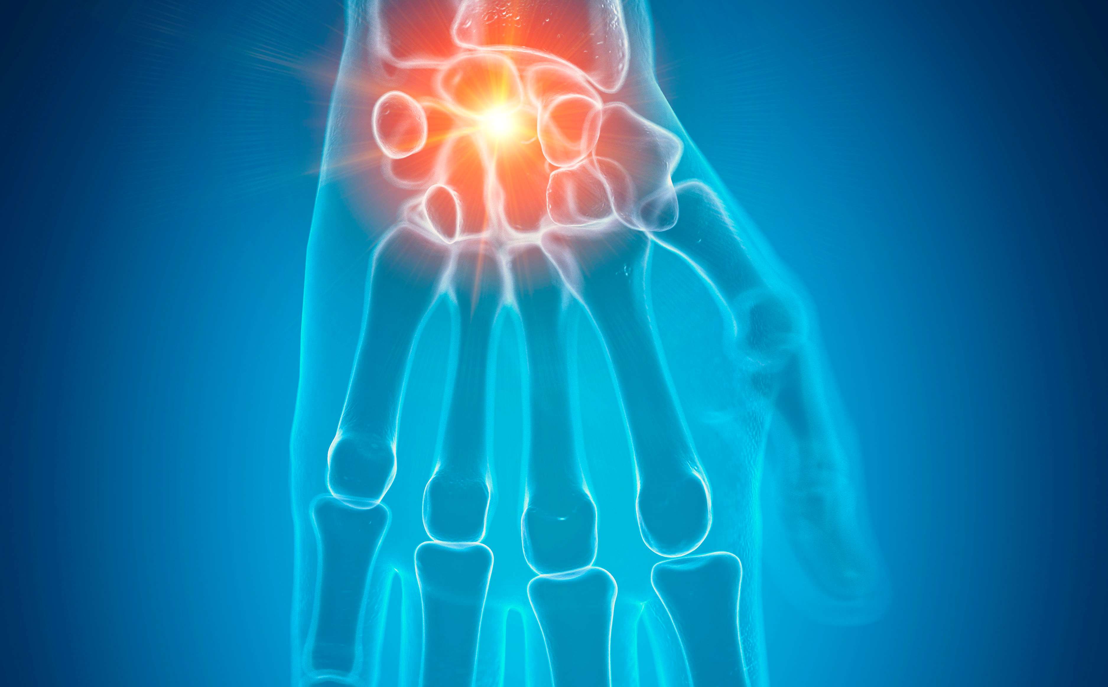 Wrist_Image Card