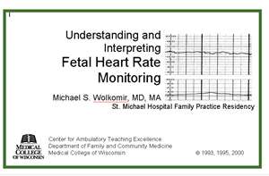 Understanding and Interpreting Fetal Heart Rate Monitoring 