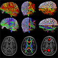 Integrative Neural Engineering & Rehabilitation Lab at Marquette University