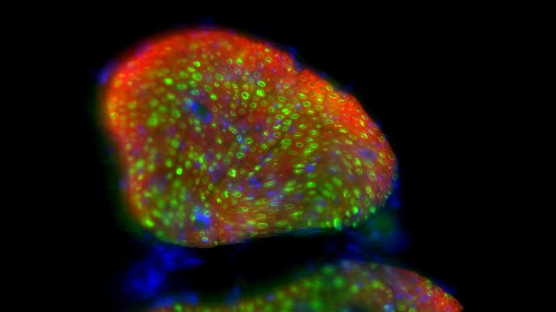 Histological image of cross-section of nerve expressing channel-rhodopsin using optogenetics.
