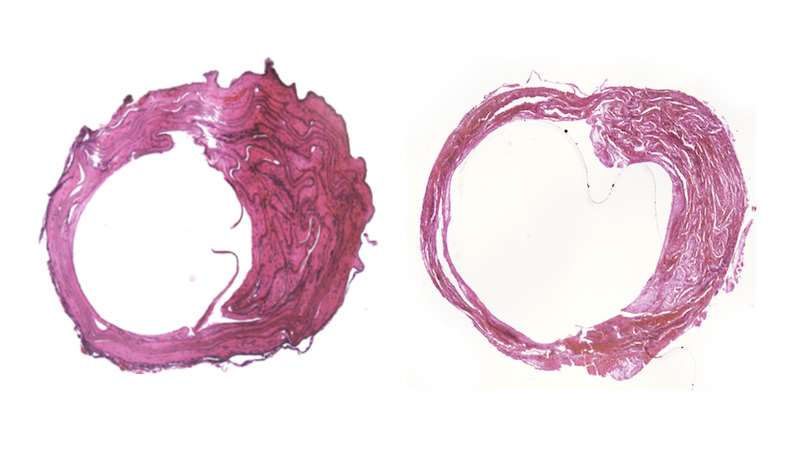 Blood vessel tissue