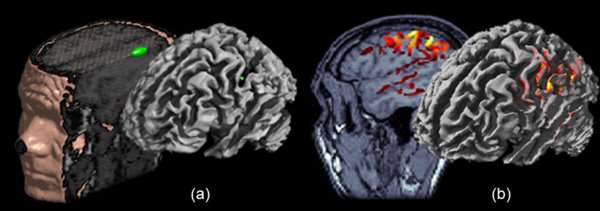 Inverse modeling: the localization approach vs. imaging approach