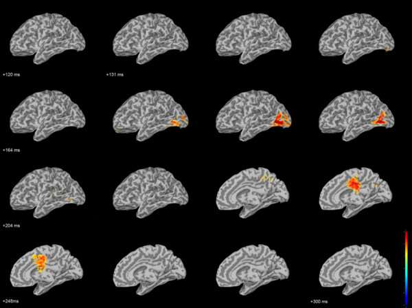 Distributed source imaging of the [120,300] ms time interval following the presentation of the target face object