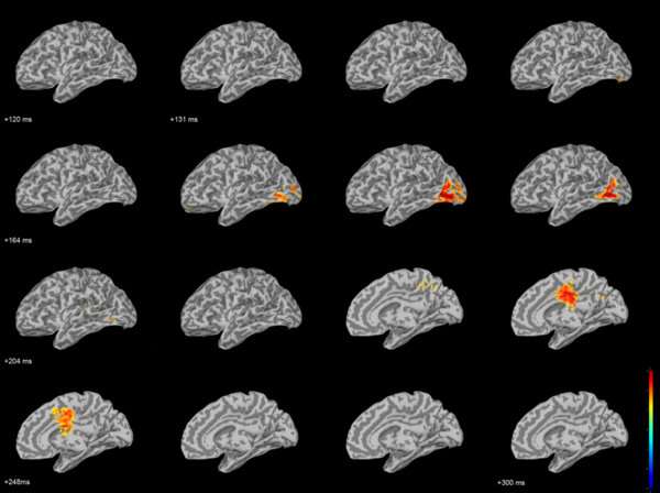 Meg Data Research Activities | Magnetoencephalography (MEG) Program | Medical ...