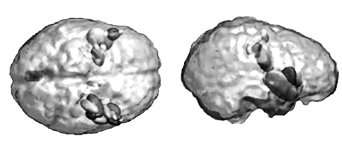 non parametric estimates of confidence intervals on source parameters (the somatotopic cortical representation of hand fingers at 200 ms following hand finger stimulation)