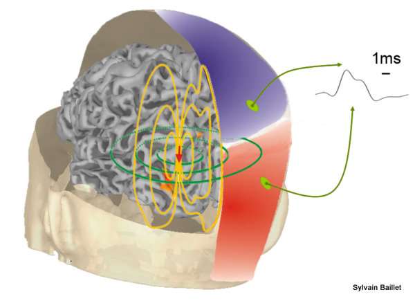 Example: brain source to scalp signal