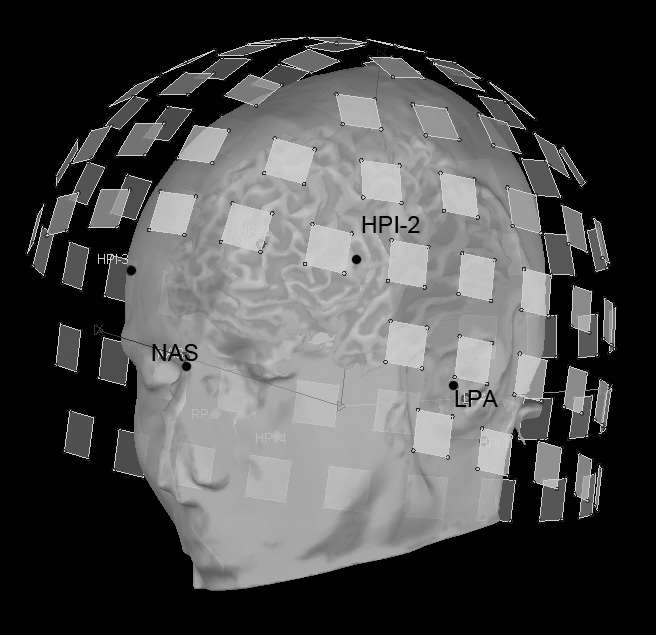 Multimodal MEG/MRI geometrical registration