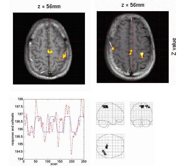 fMRI