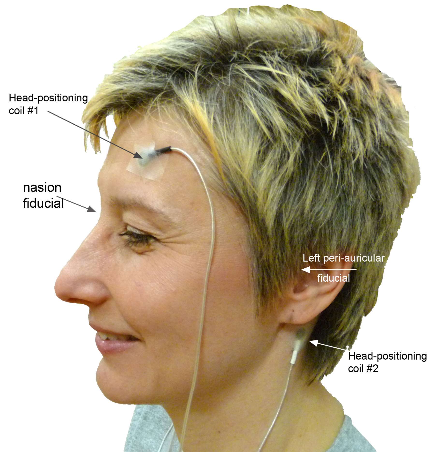 Fiducial points and Head-positioning coils