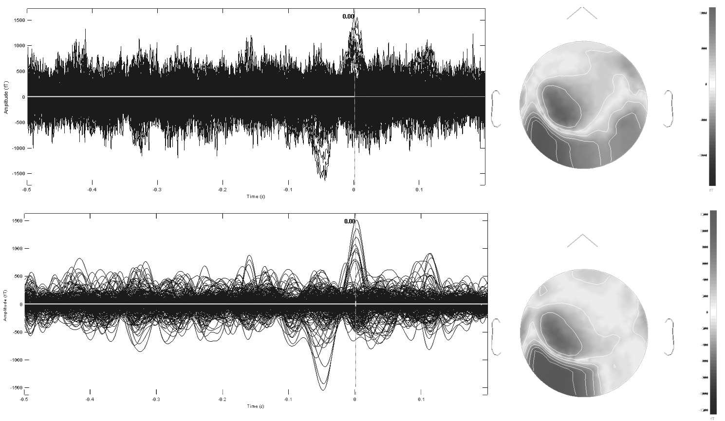 Signal tracings before and after filtering, as well as their field topography maps