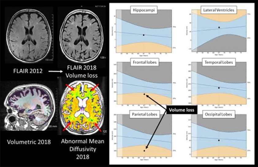 NTRP FLAIR-MRI Figure 1