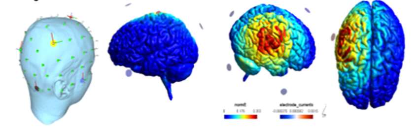 NTRP Study of HD-tDCS in aMCI Figure 3