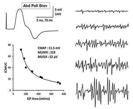 Neuromuscular EMG Lab MUNIX Figure 3