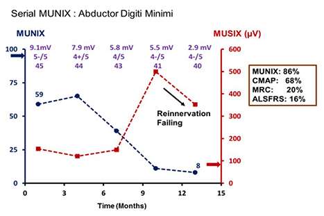 Neuromuscular EMG Lab MUNIX Figure 4