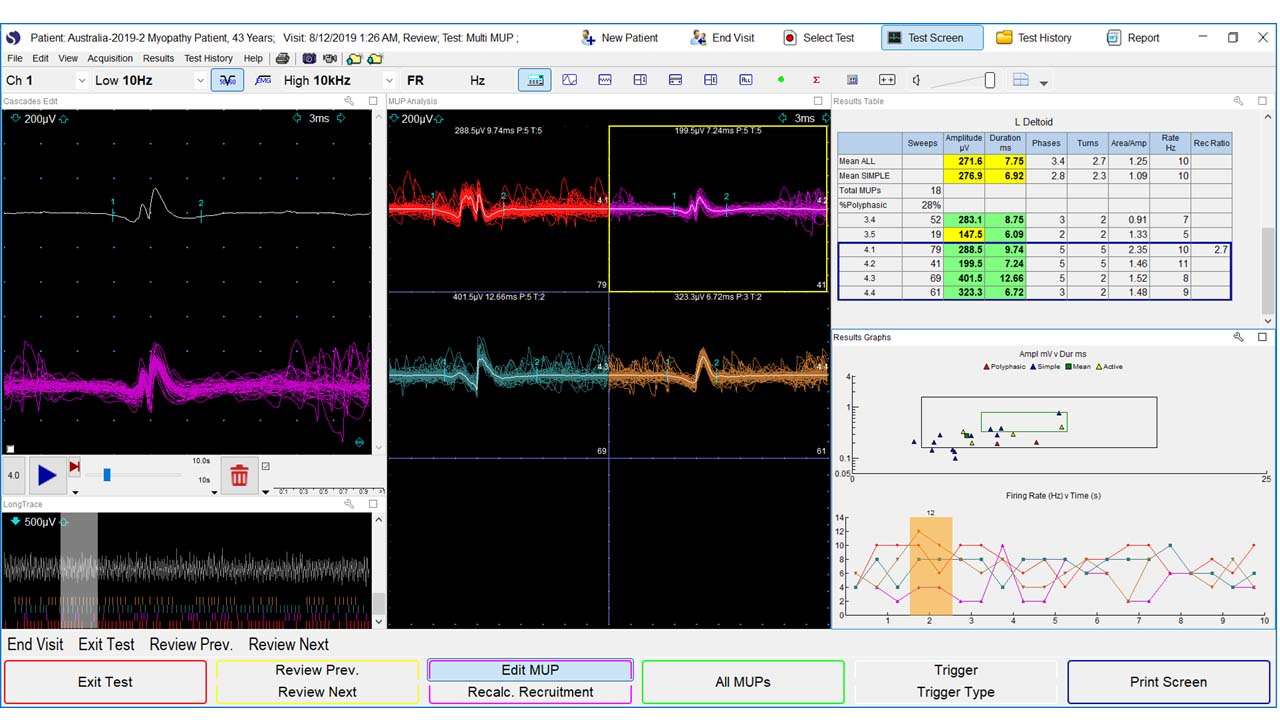 Neuromuscular EMG Lab Needle Electromyography Figure 1