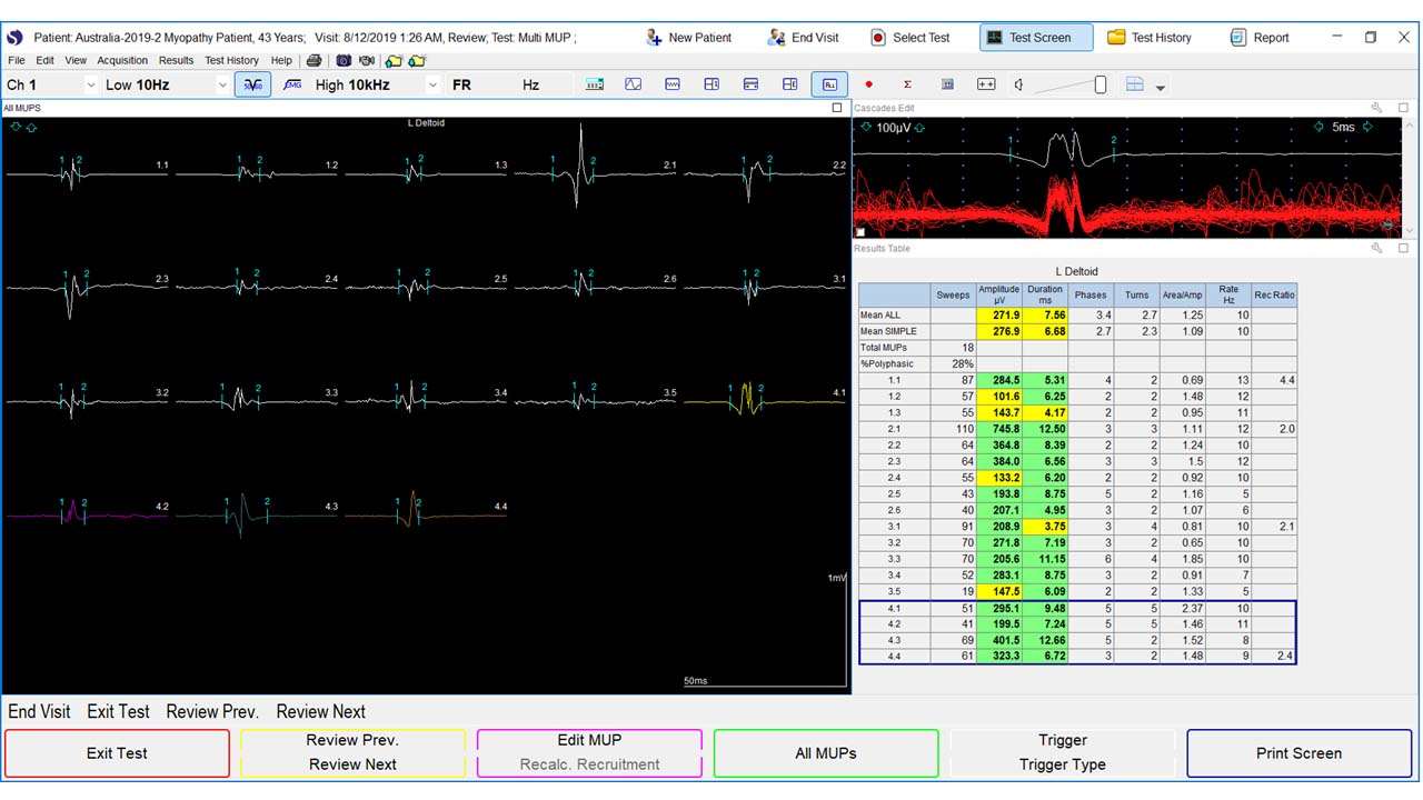 Neuromuscular EMG Lab Needle Electromyography Figure 2