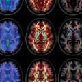 Images of Brain captured by Dr. Kevin Koch and the Center for Imaging Research