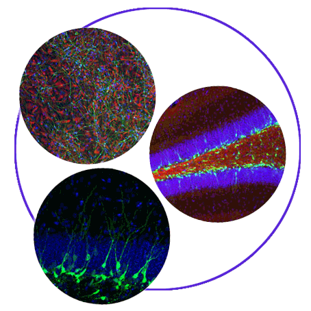 Three circular imaging samples of excited neurons with overlapping purple ring