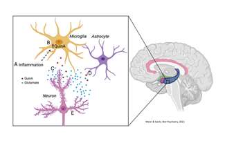 Concussion Biomarkers