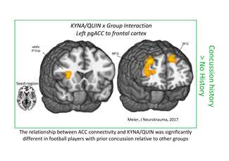 ACC connectivity and KYNA/QUIN relationship significantly different in persons with prior concussion history