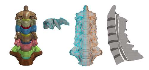 Finite Element Models of Cervical Spine (x3) and disk (x1)