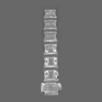 X-ray of cervical spine from Yoganandan Laboratory