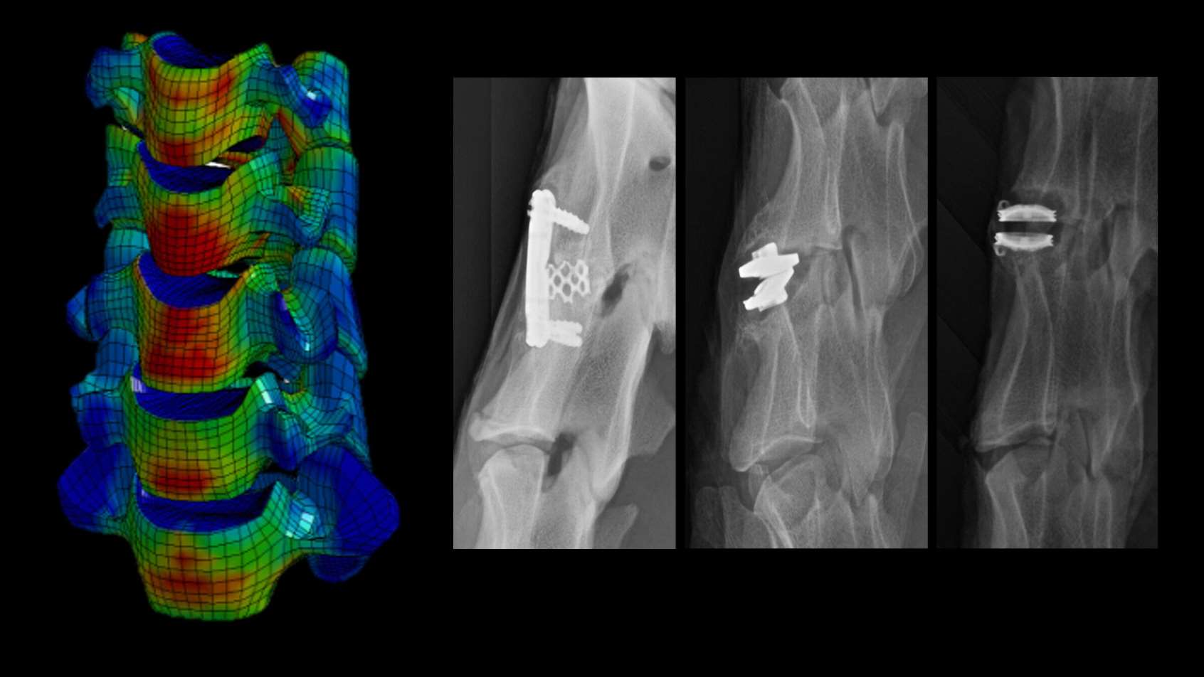ZVAMC Spine Biomechanics