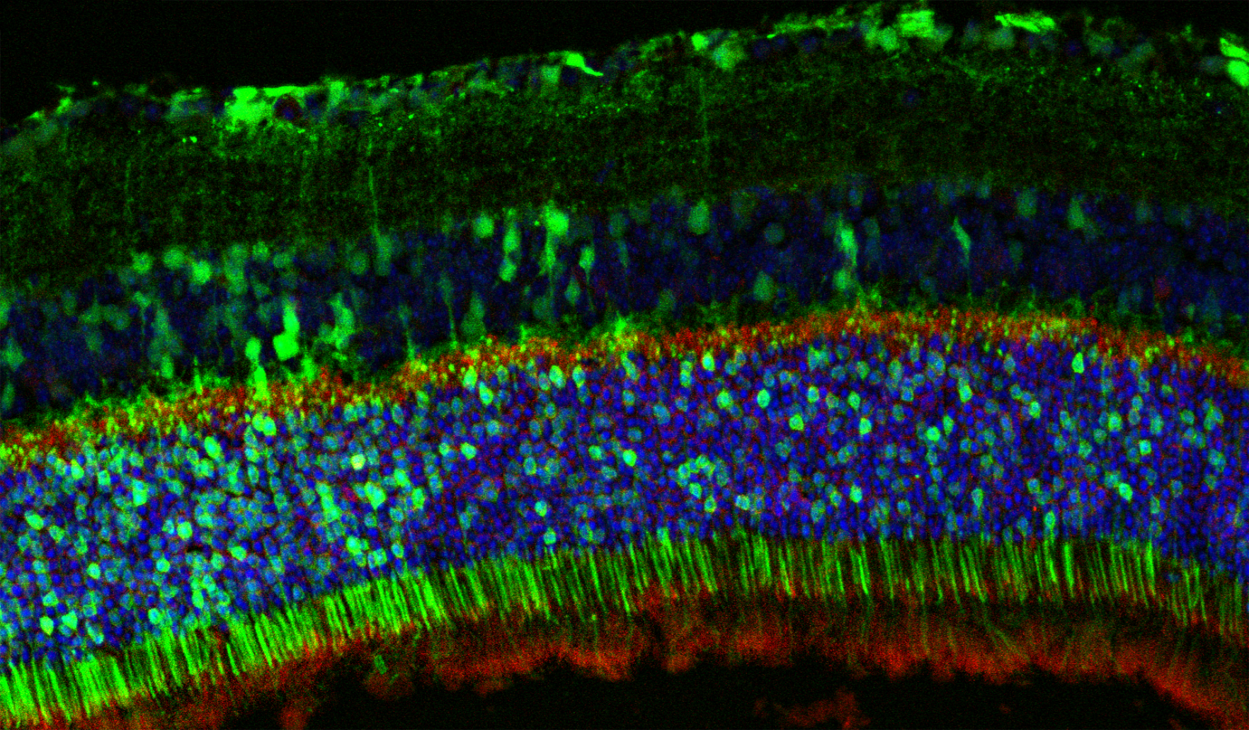 ResearchImage3_RareDisease_Stacked Image Text Split Component