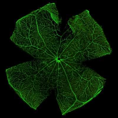 Isolectin Staining_Chaurasia lab