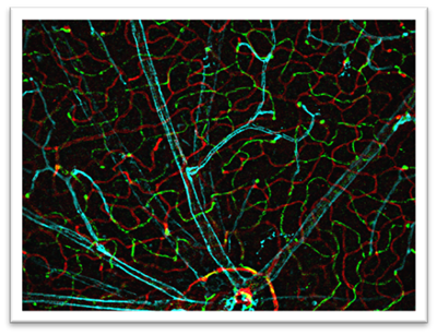 OIAL Decorin in the Retinal Vascular Development
