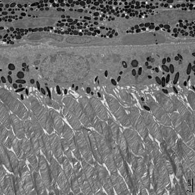 Photoreceptors and RPE_Chaurasia lab