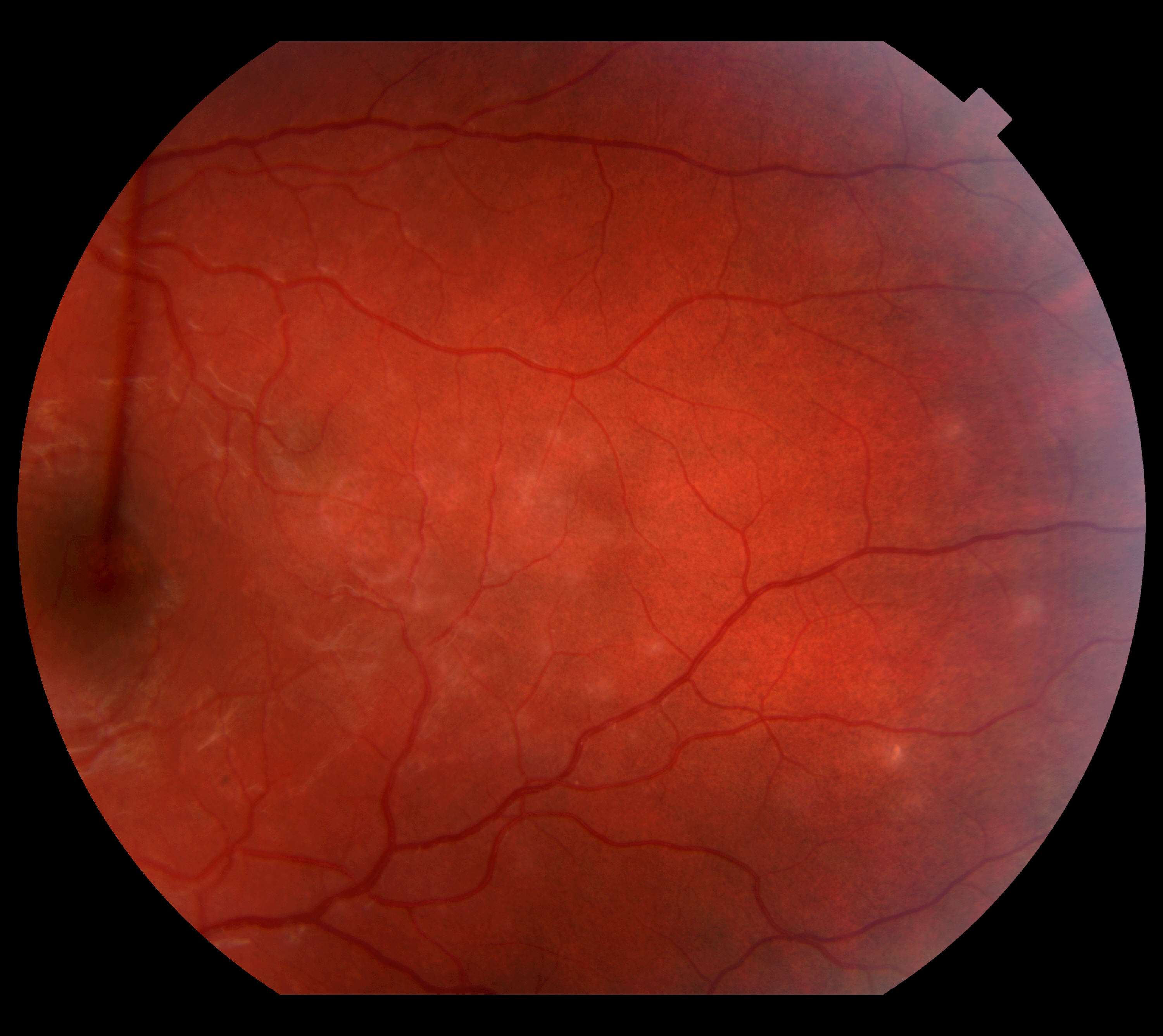 Case 1 periphery