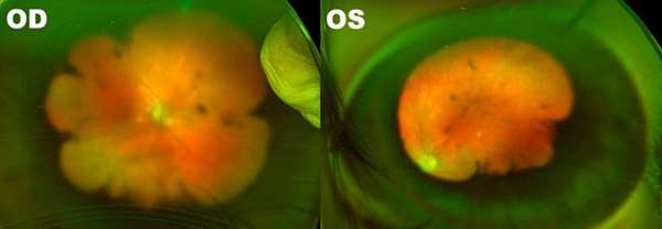 Optos Imaging